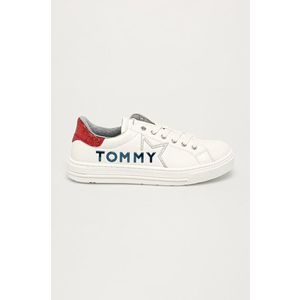 Tommy Hilfiger - Dětské boty obraz