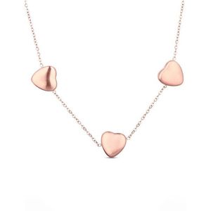 VUCH Náhrdelník Rose gold Sparkle obraz